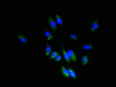 TSPAN1 Antibody