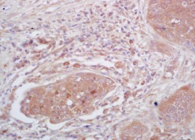 TSPAN9 Rabbit Polyclonal Antibody