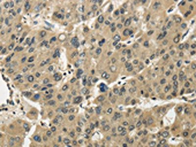 EIPR1 Antibody
