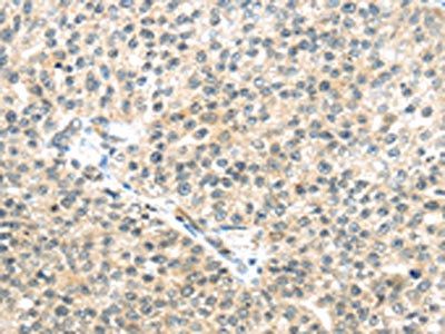 TTBK2 Antibody