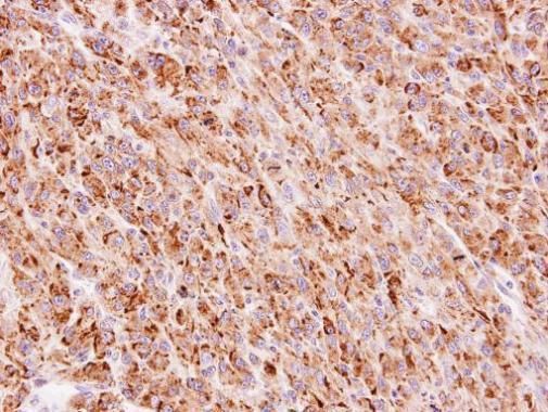 TTC30A Rabbit Polyclonal Antibody