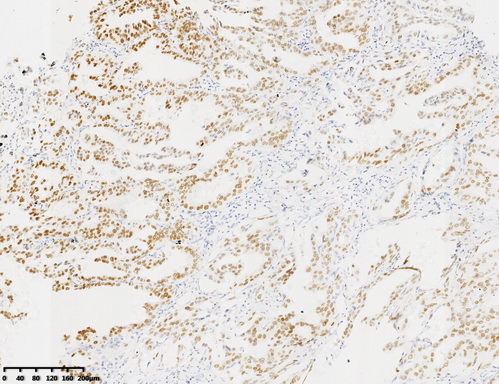 TTF1 Antibody