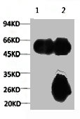 TUBA1A Antibody