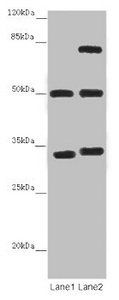 TUBA1B Antibody