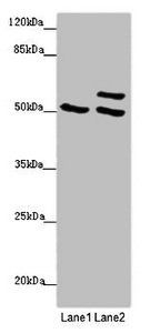 TUBB4A Antibody