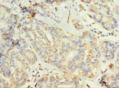 TUBG2 Antibody