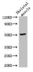 TUBG2 Antibody