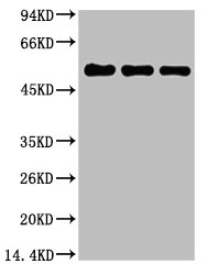 TUBB1 Antibody