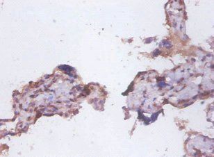 FAS Antibody