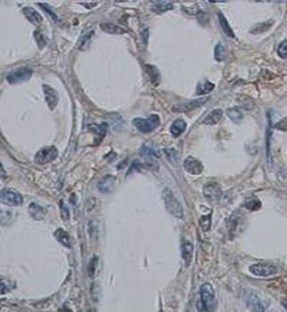 Tumstatin Rabbit Polyclonal Antibody