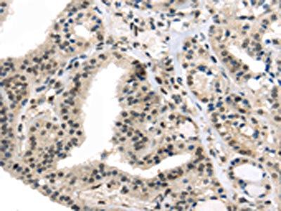 TUSC5 Antibody