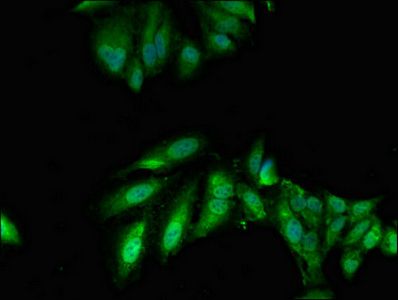 TWF1 Antibody