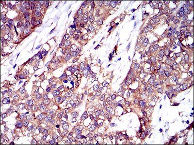 TWF1 Antibody