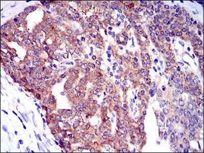 TWF1 Antibody