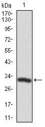 TWF1 Antibody