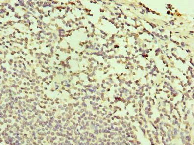TXNDC11 Antibody