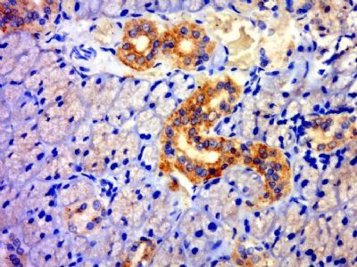 TXNDC11 Rabbit Polyclonal Antibody