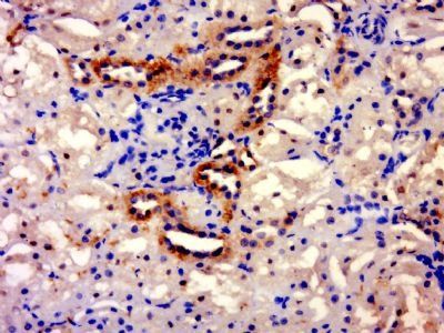 TXNDC11 Rabbit Polyclonal Antibody