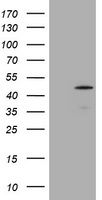TXNDC5 Antibody