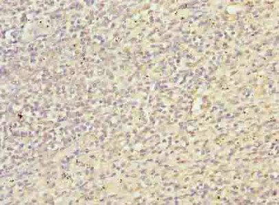 TXNRD1 Antibody