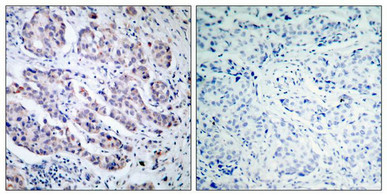 TYK2 Antibody