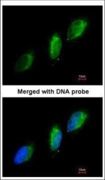 TYK2 antibody [C1C3]