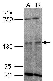 tyrosine kinase 2 Antibody