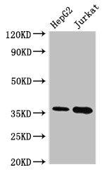 TYMS Antibody