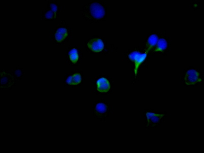 TYR Antibody