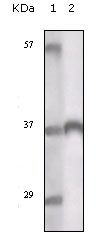 TYRO3 Antibody