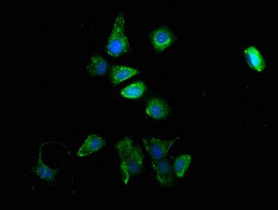 TYR Antibody