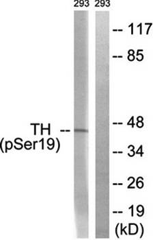 Tyrosine Hydroxylase (Phospho-Ser19) Antibody