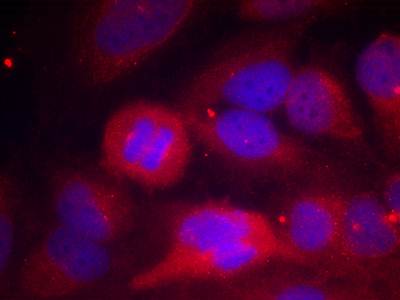 Tyrosine Hydroxylase (Phospho-Ser40) Antibody