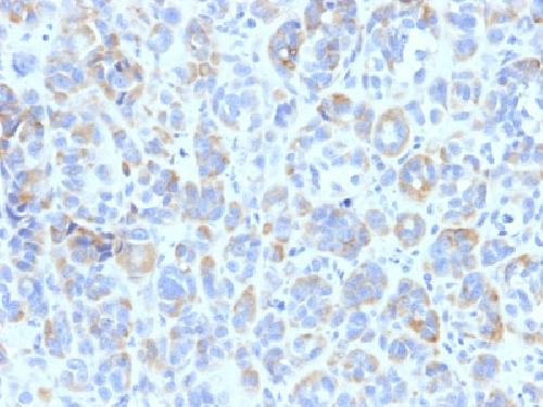 TYRP1 Antibody