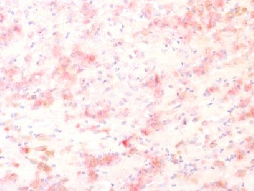 TYRP1 Antibody