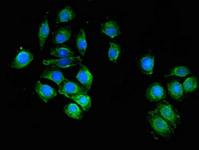 UAP1 Antibody