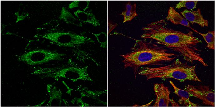 UAP1 Rabbit Polyclonal Antibody