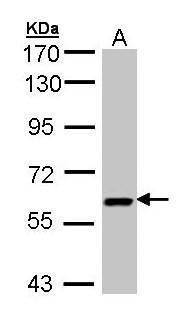 UAP1 Rabbit Polyclonal Antibody