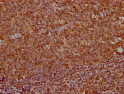 UBB Antibody