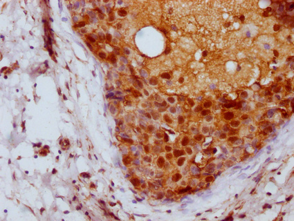 UBB Antibody
