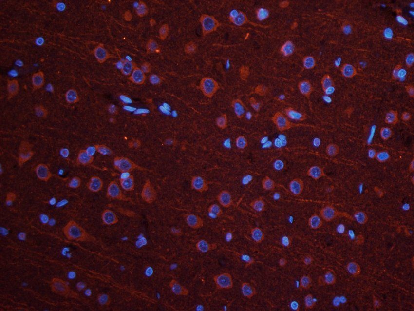 UBC12 Rabbit Polyclonal Antibody