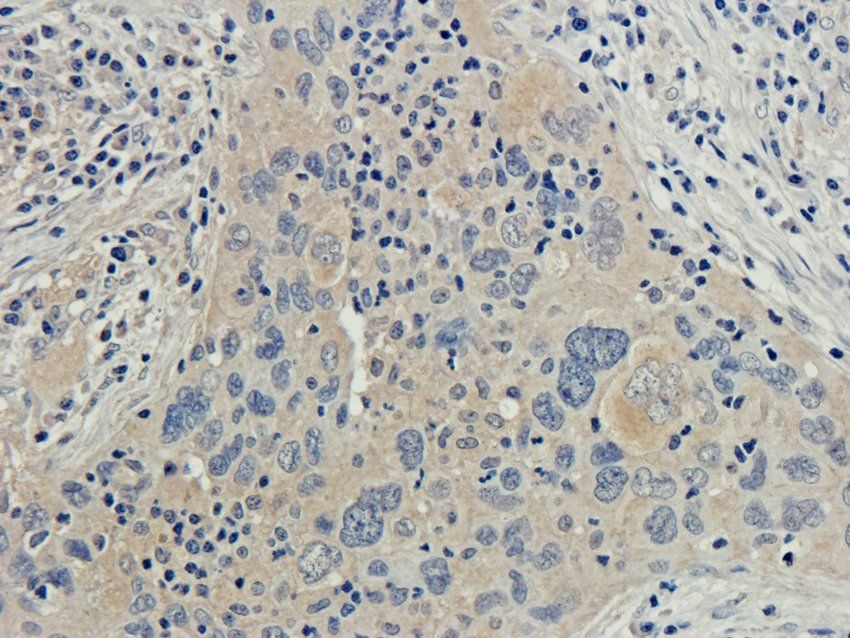 UBC12 Rabbit Polyclonal Antibody