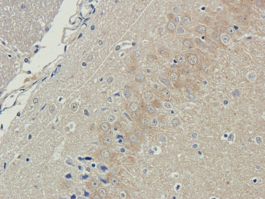 UBC12 Rabbit Polyclonal Antibody