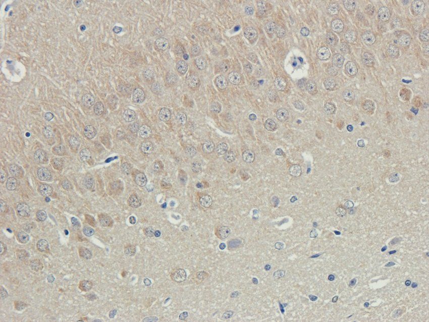 UBC12 Rabbit Polyclonal Antibody