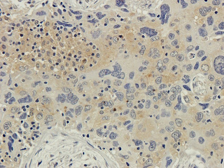 UBC12 Rabbit Polyclonal Antibody