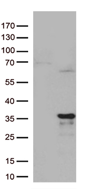 UBE1C Antibody