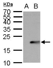 UBE2B antibody