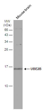 UBE2B antibody