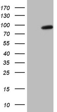 UBE2D1 Antibody