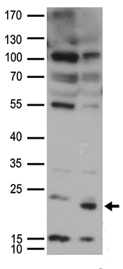 UBE2I Antibody